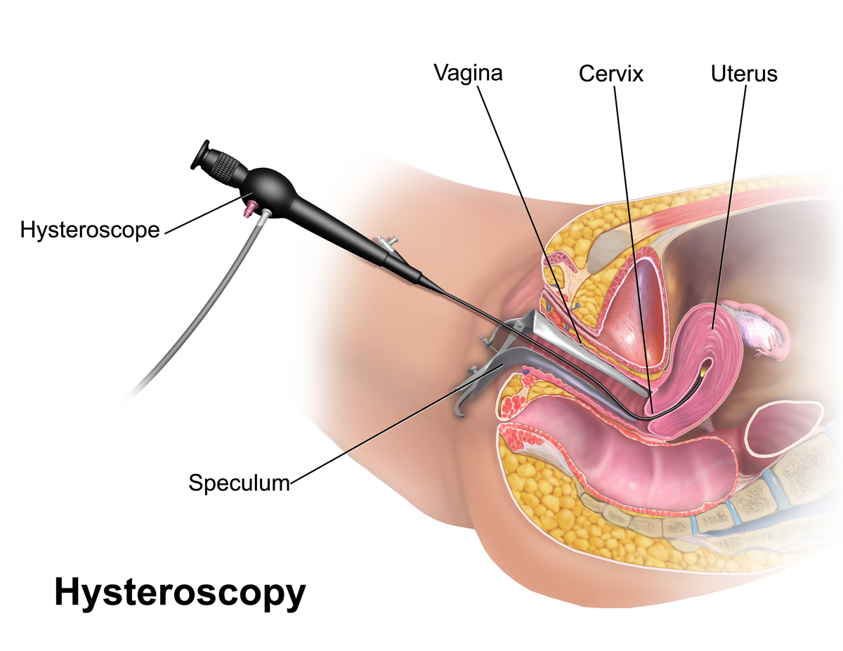 Hysteroscopy Anatomy and Examination Architecture