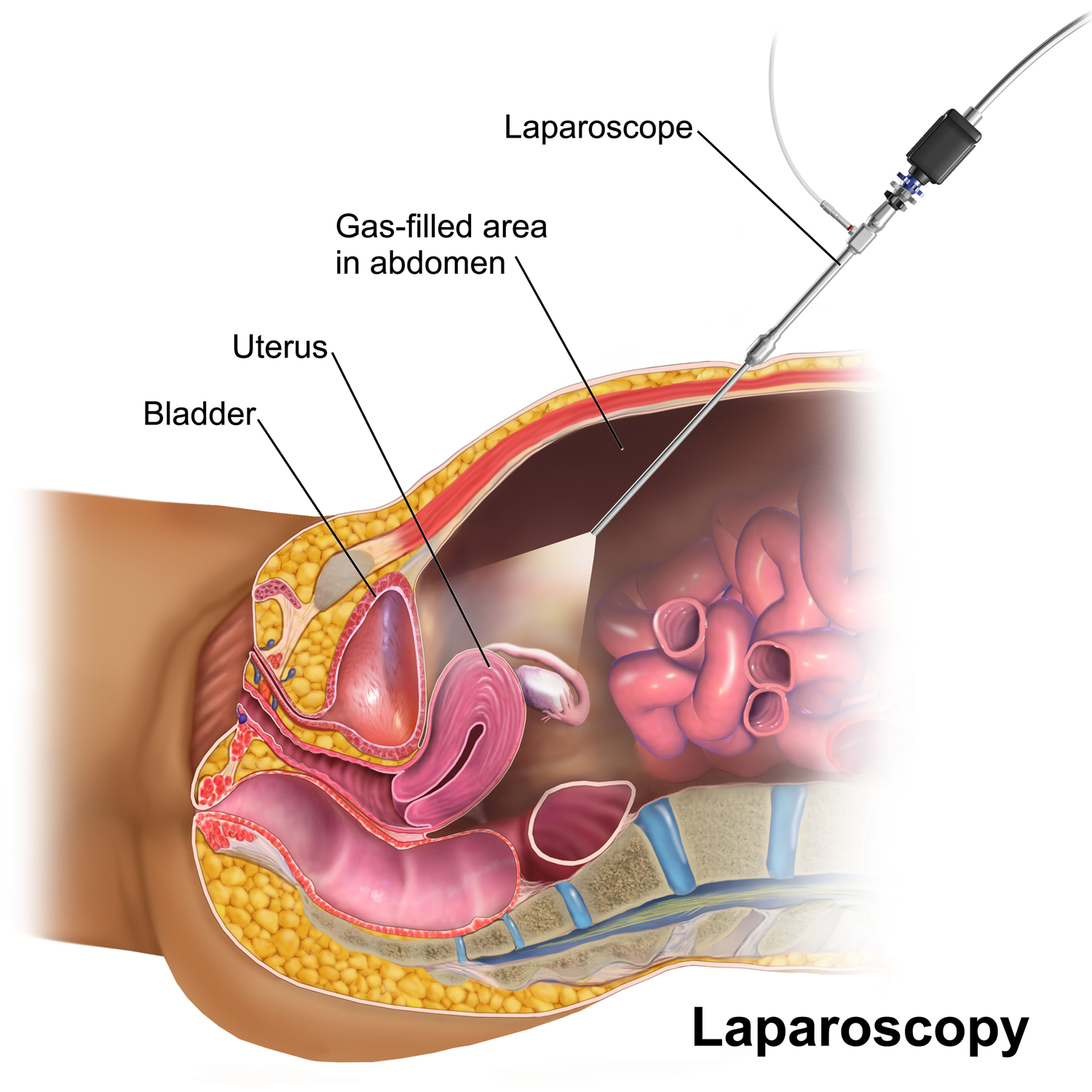 Advanced Laparoscopic Operating Theatre Setup and Patient Positioning